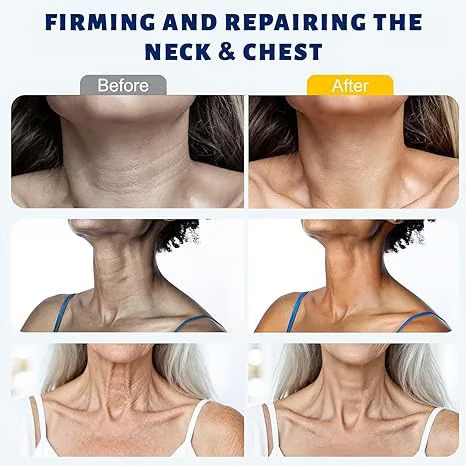 AUROLYSE™ 5-Roller Neck Firming Cream – Collagen & Hyaluronic Acid for Smoother, Tighter-Looking Neck Skin
