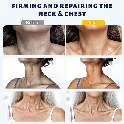 AUROLYSE™ 5-Roller Neck Firming Cream – Collagen & Hyaluronic Acid for Smoother, Tighter-Looking Neck Skin