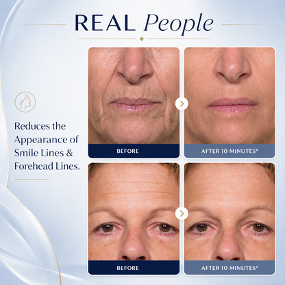 AUROLYSE™ Under Eye Bag & Wrinkle Treatment