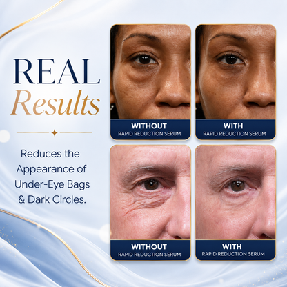 AUROLYSE™ Under Eye Bag & Wrinkle Treatment